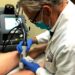 Guía de causas y riesgos de varices