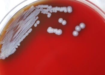 Detectan en Estados Unidos bacteria que causa melioidosis