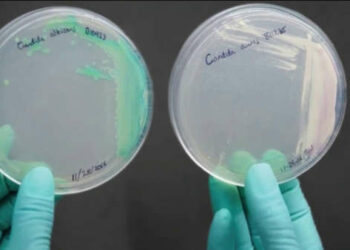 Hospitales al sur de Florida en alerta por hongo potencialmente letal