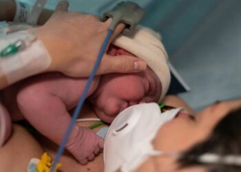 Neonatos de madres con COVID-19 podrían tener lesiones cerebrales