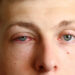 Se extiende en Florida nueva variante del Covid-19 que causa conjuntivitis