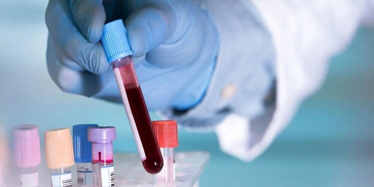 Cuatro biomarcadores y un fármaco podrían redefinir el tratamiento de la diabetes