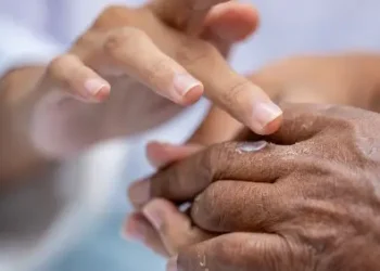 Florida entre los estados con más casos de lepra en EEUU