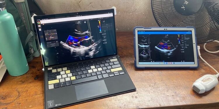 Cómo funciona la herramienta de IA que puede diagnosticar una enfermedad cardíaca oculta en los niños