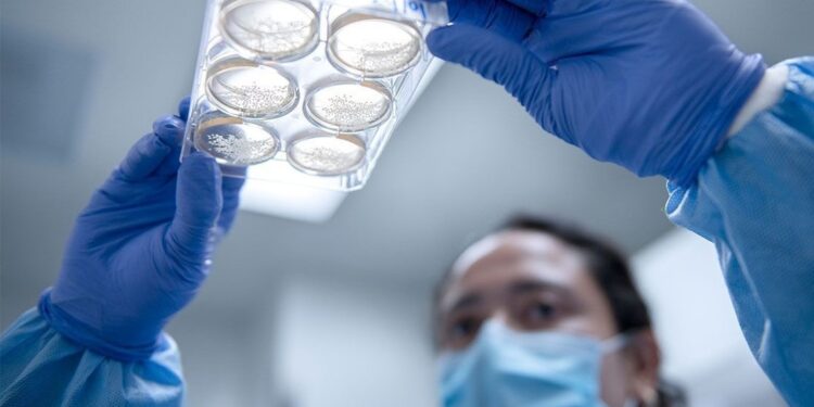 Nueva investigación con minicerebros humanos confirma una impactante teoría sobre el autismo