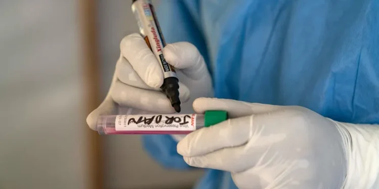 La OMS intenta transmitir tranquilidad ante el brote de mpox en África y un único caso en Europa