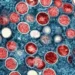 La OMS advierte que es probable que haya más casos de viruela del mono en Europa