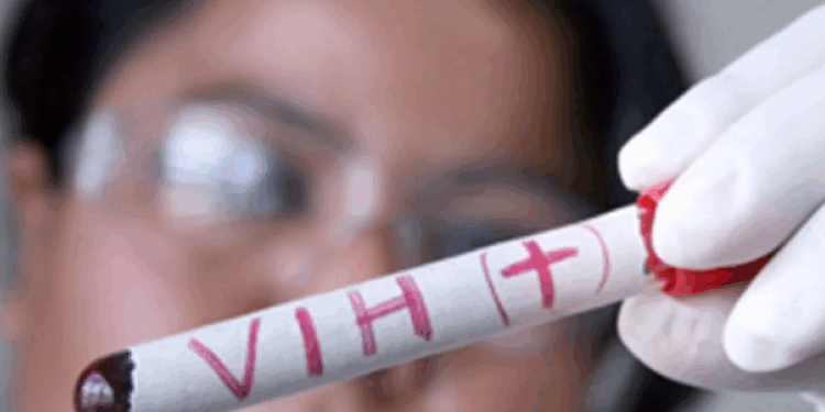 Cuatro millones de personas podrían morir de sida por los recortes de EEUU